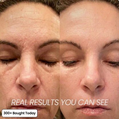 Junazilo® Collagen Plump & Repair Balm upsell