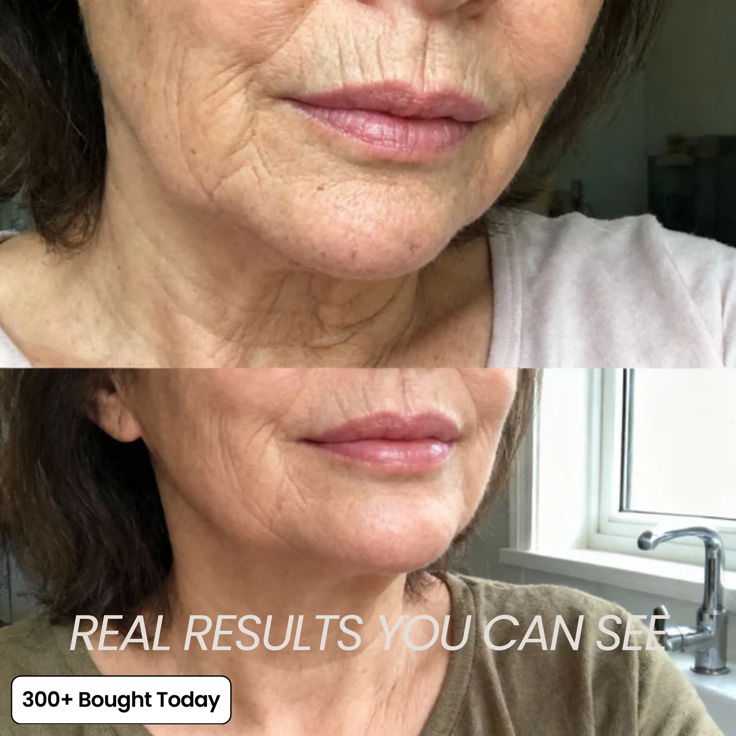 Junazilo® Collagen Plump & Repair Balm upsell