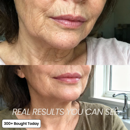 Junazilo® Collagen Plump & Repair Balm upsell