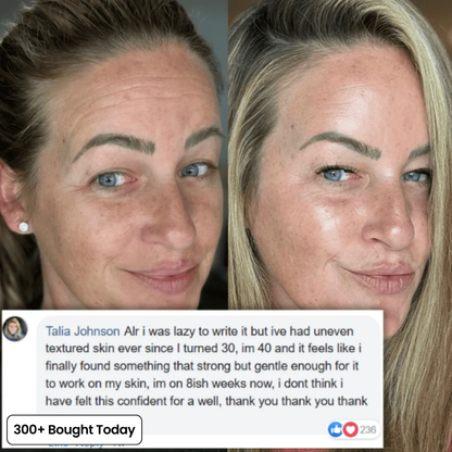 Junazilo® Collagen Plump & Repair Balm upsell