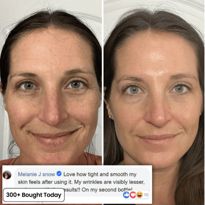 Junazilo® Collagen Plump & Repair Balm upsell